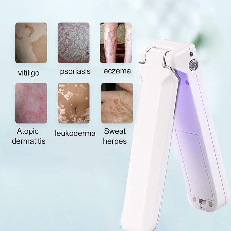 woobles UV Treatment Light, Leukoplakia Promoting Blackening Vitiligo Lamp Handheld Foldable Light, Light Lamp for Women Men - Image 3